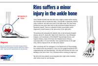 CT Scan Kondisi Alex Rins