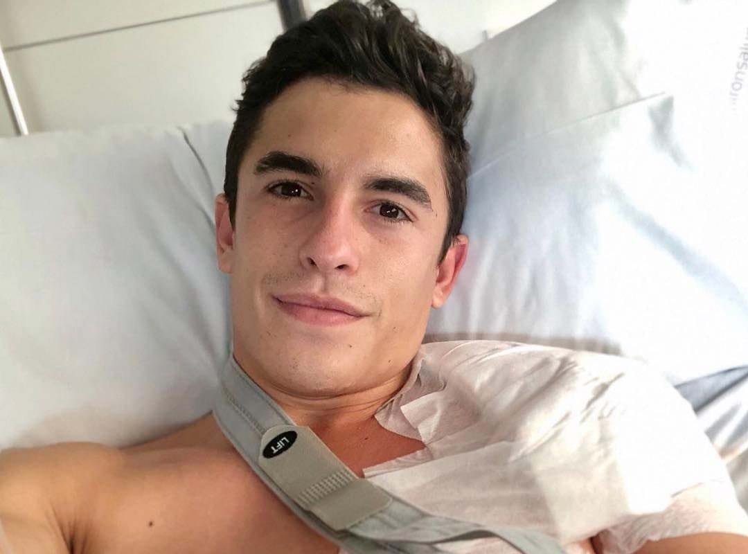 Marc Marquez menjalani Operasi Bahu Marc Marquez menjalani Operasi Bahu